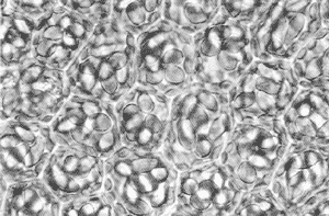 Клетки печеночного мха с масляными тельцами